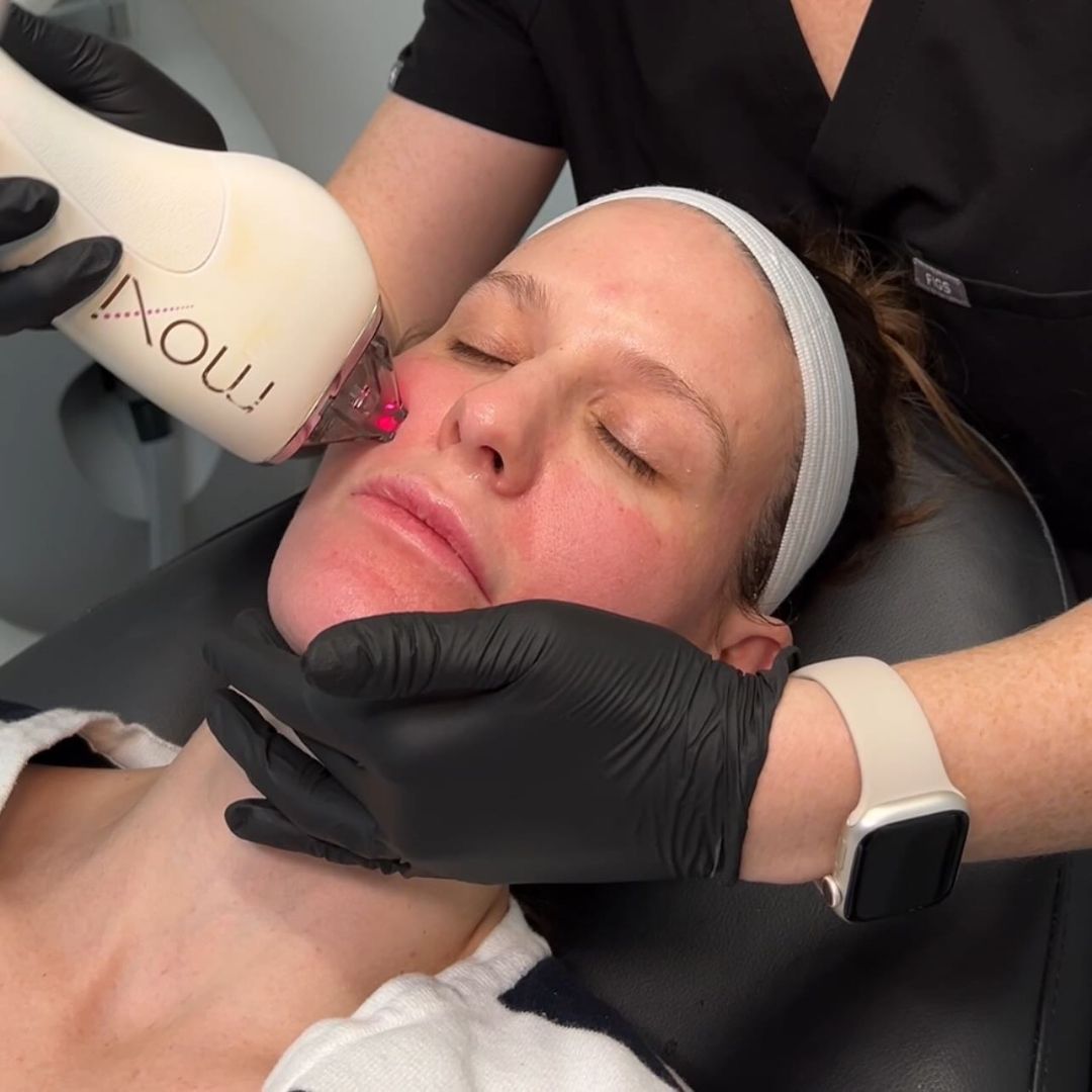Moxi treatment