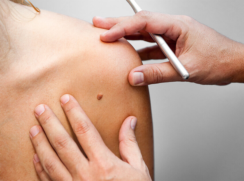 bare shoulder being examined with a doctor's hands