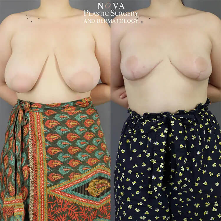 Actual Patient Results 2