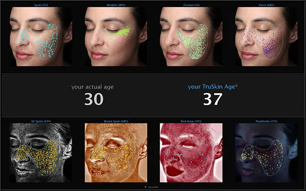 Visia Results