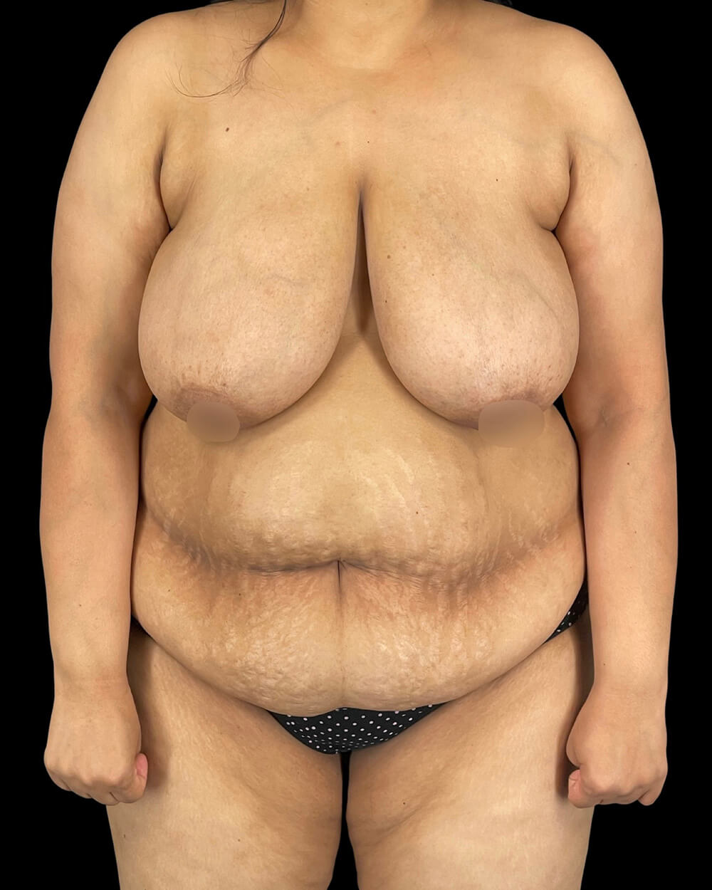 Case--7945 | Before Body