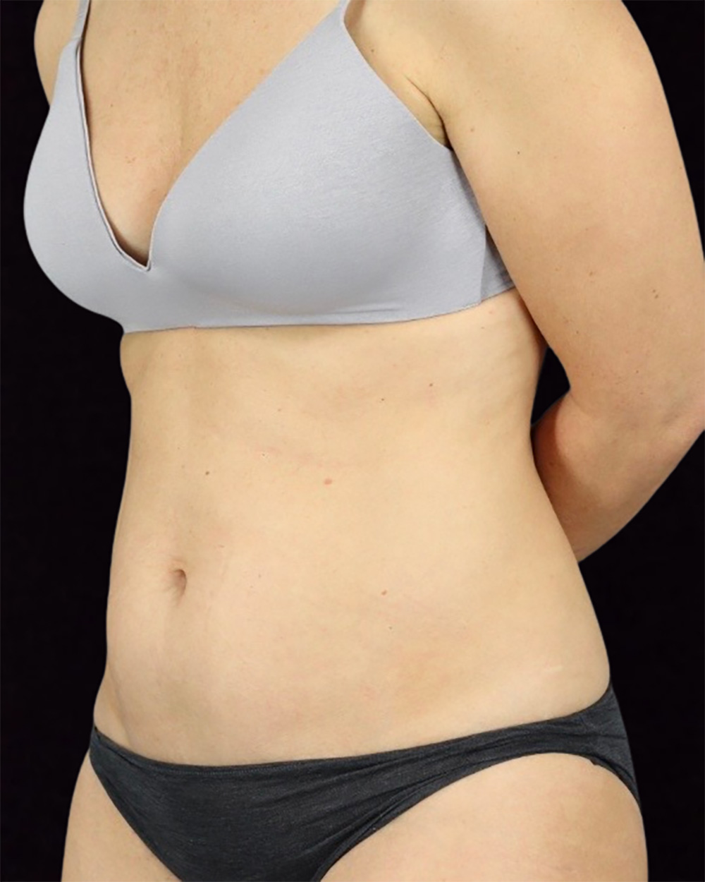 Case--2906 | Before Body