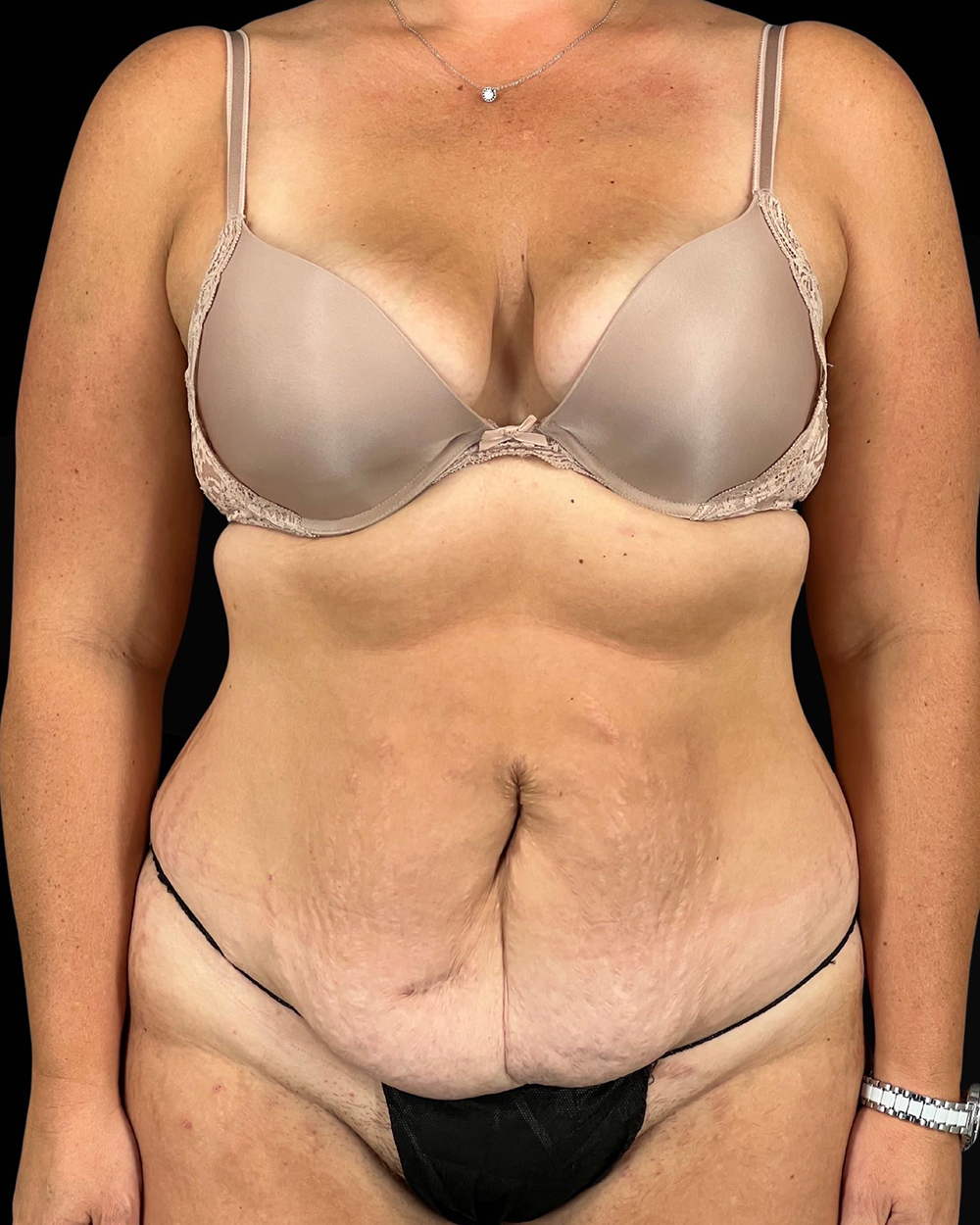 Case--9283 | Before Fadi Nukta, MD FACS