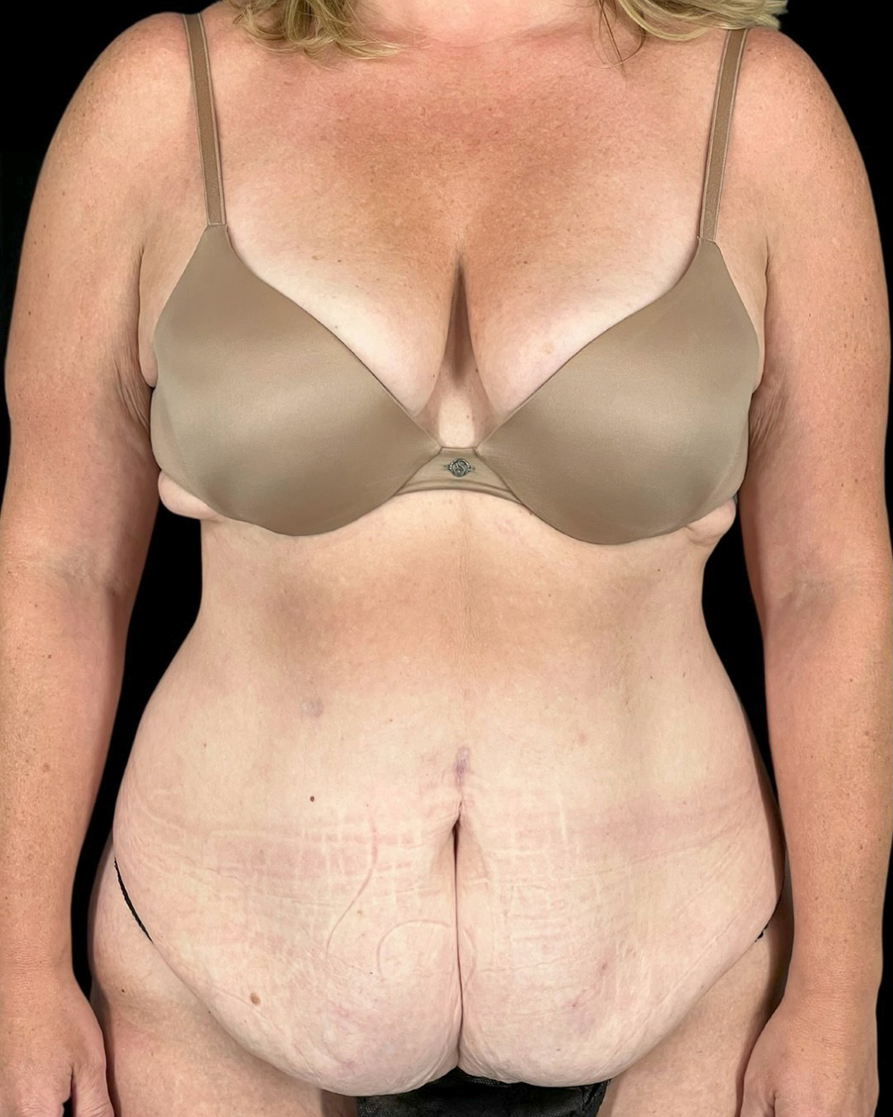 Case--6580 | Before Fadi Nukta, MD FACS