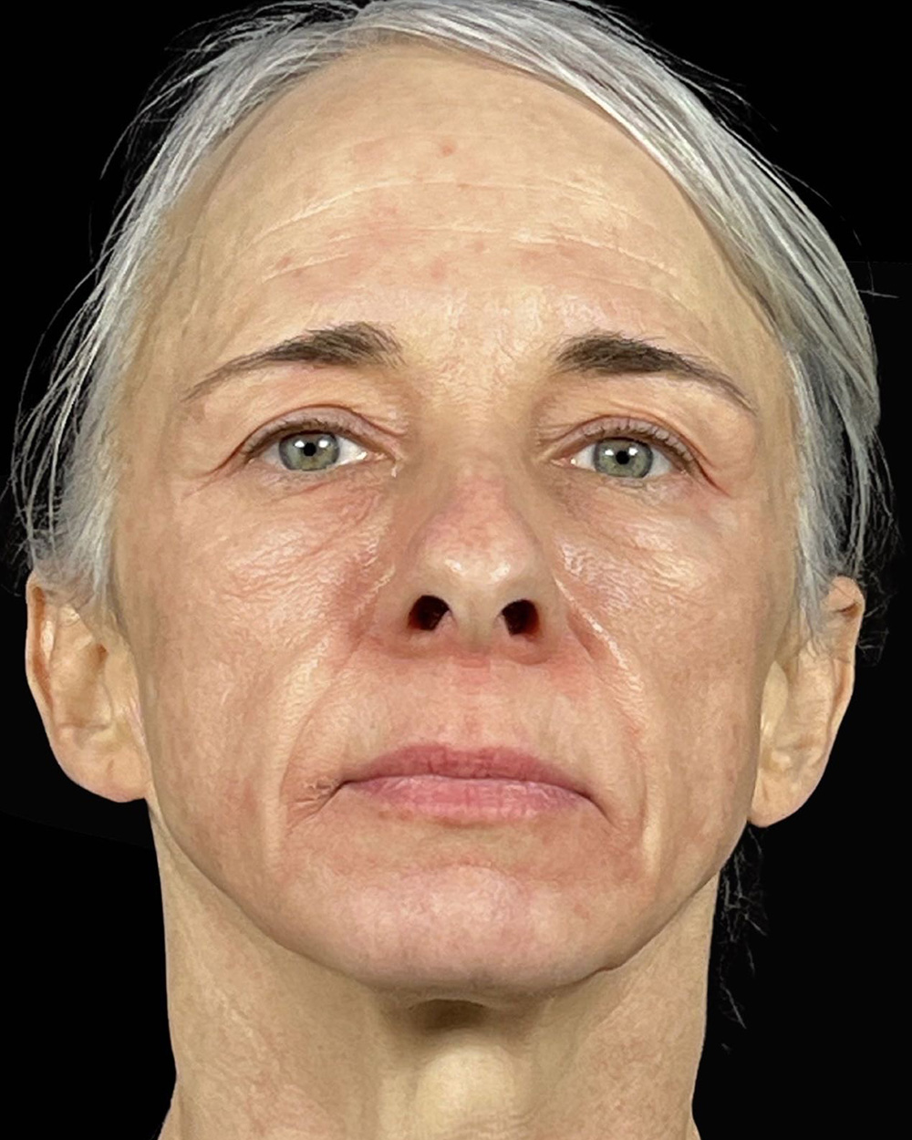 Case--7507 | Before Face
